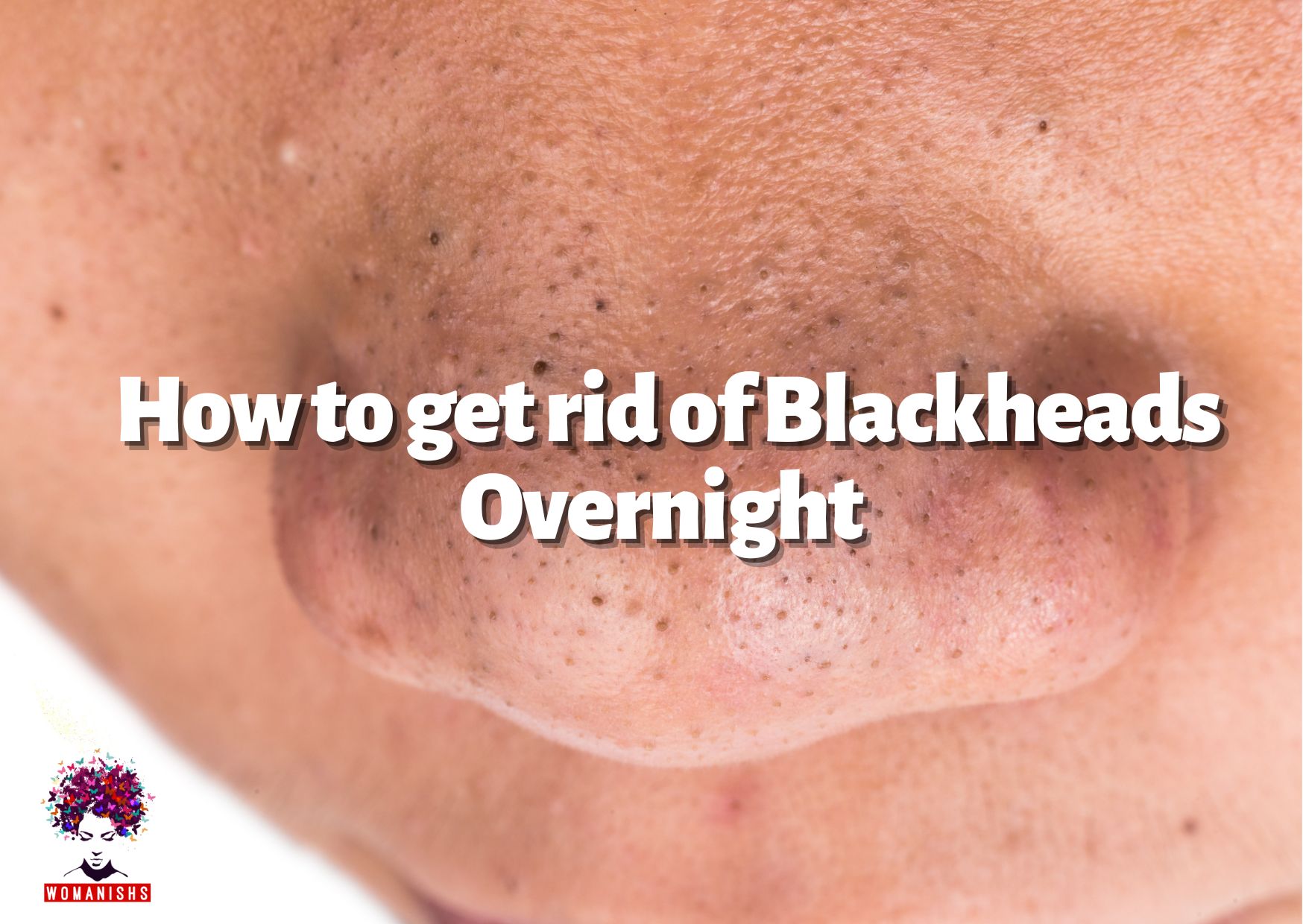 How to get rid of Blackheads Overnight
