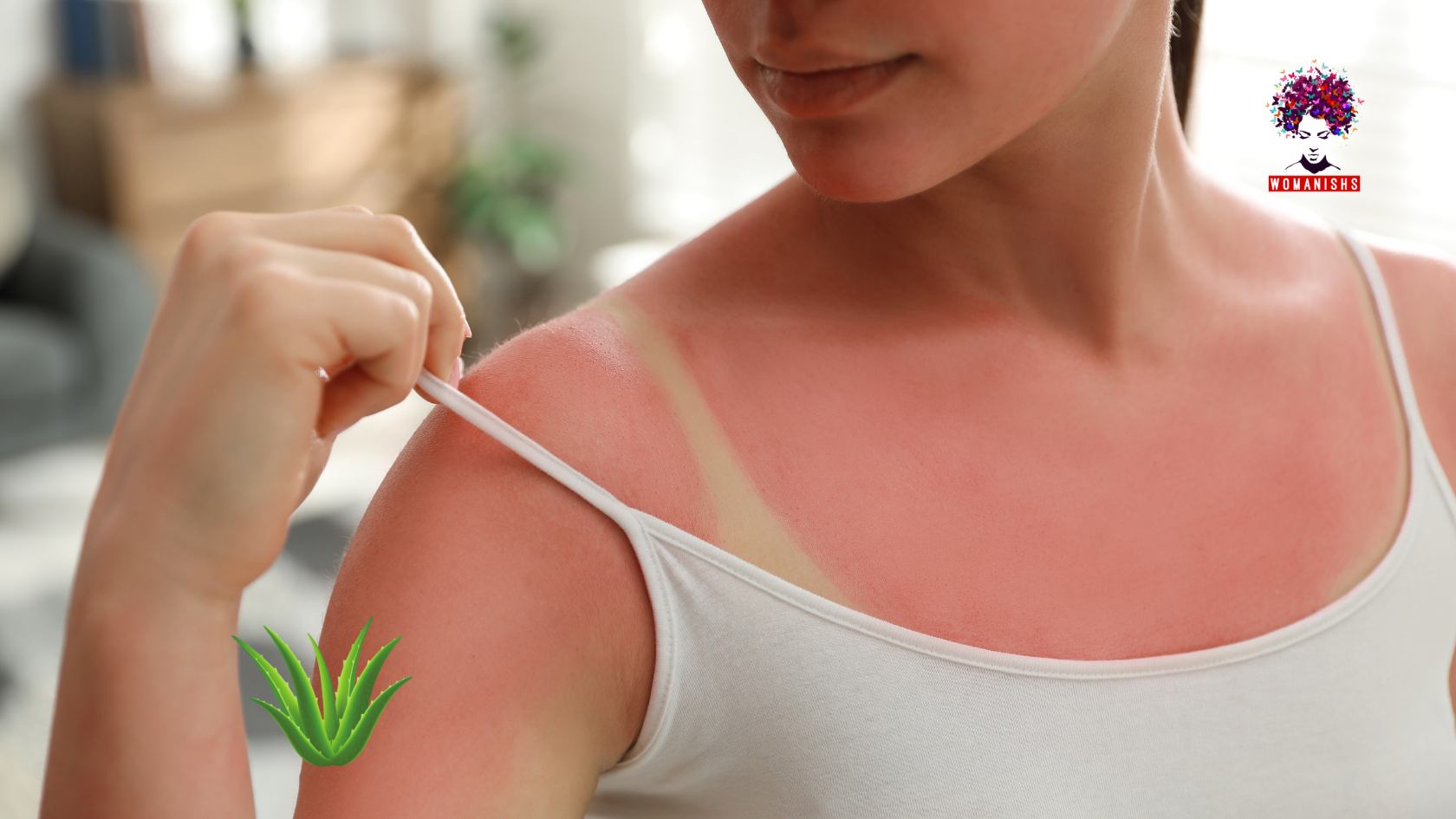 Helps to Heal Sunburn and Small Cuts